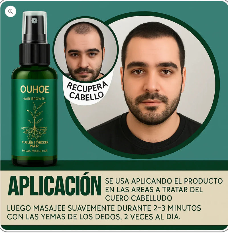 VitalHair© Recupera tu confianza desde la raiz en 2 semanas