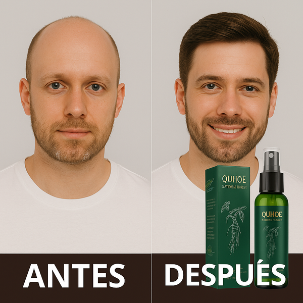 VitalHair© Recupera tu confianza desde la raiz en 2 semanas
